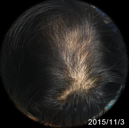 20151103